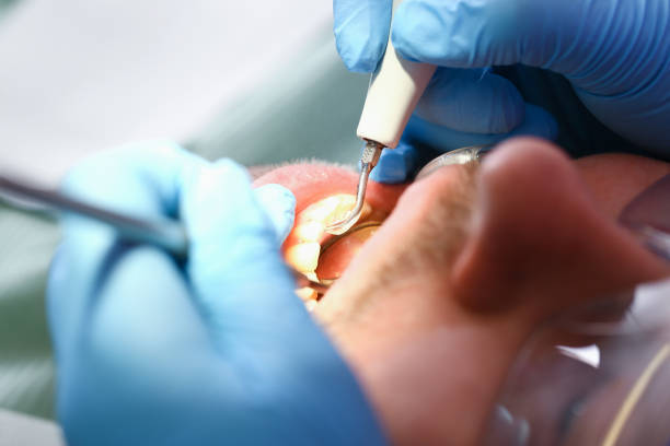 Best Emergency Broken Tooth Repair in Cleburne, TX